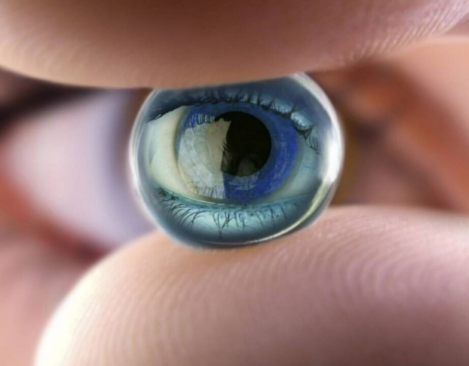 Öised ortokeratoloogilised läätsed peatavad visuaalse kahjustuse edenemise